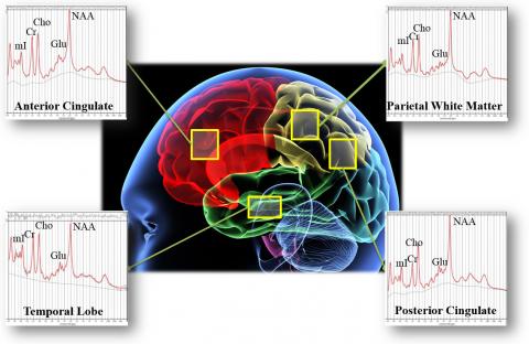 A virtual biopsy conducted by magnetic resonance spectroscopy Image Credit: Alex Lin, Harvard Medical School