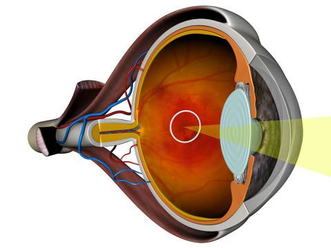 Draper's Wet AMD diagnostic capability is intended to identify those patients who are most likely to benefit from invasive therapies before irreversible damage takes place.